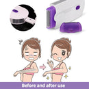 NNEOBA Painless Laser Touch Epilator Kit-4