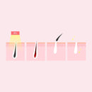 Silhouette Portable Laser Hair Remover Permanent Epliation System Body Face Home - RnR Galore